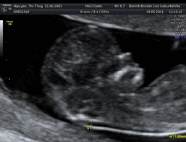 Frauenarztpraxis Dr. Gerald Bräutigam, Frauenarzt Linz