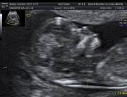 Frauenarztpraxis Dr. Gerald Bräutigam, Frauenarzt Linz