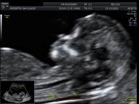 Frauenarzt Linz Dr. Gerald Br�utigam