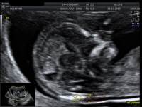 Frauenarzt Linz Dr. Gerald Br�utigam