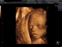 Frauenarzt Linz Dr. Gerald Br�utigam