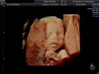 Frauenarzt Linz Dr. Gerald Bräutigam