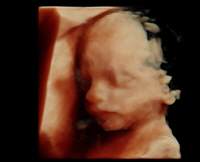 Frauenarzt Linz Dr. Gerald Bräutigam