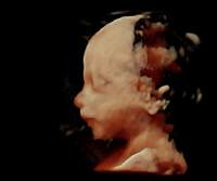 Frauenarzt Linz Dr. Gerald Bräutigam